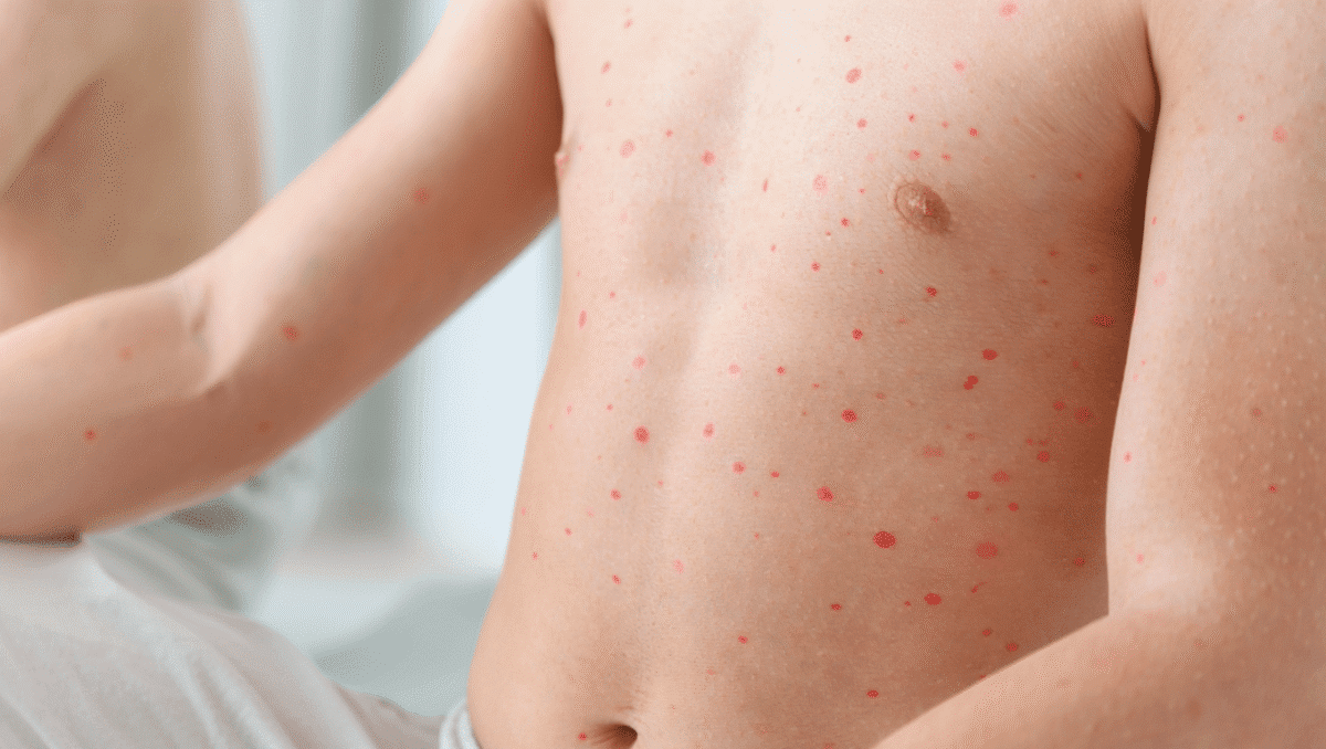 Dermatologie – 24 avr. 2024Points rouges sur le corps : tout savoir sur les pétéchies Nos médecins généralistes vous disent tout sur cette affection cutanée souvent banale, mais qui peut aussi parfois révéler une pathologie sous-jacente.En savoir plus