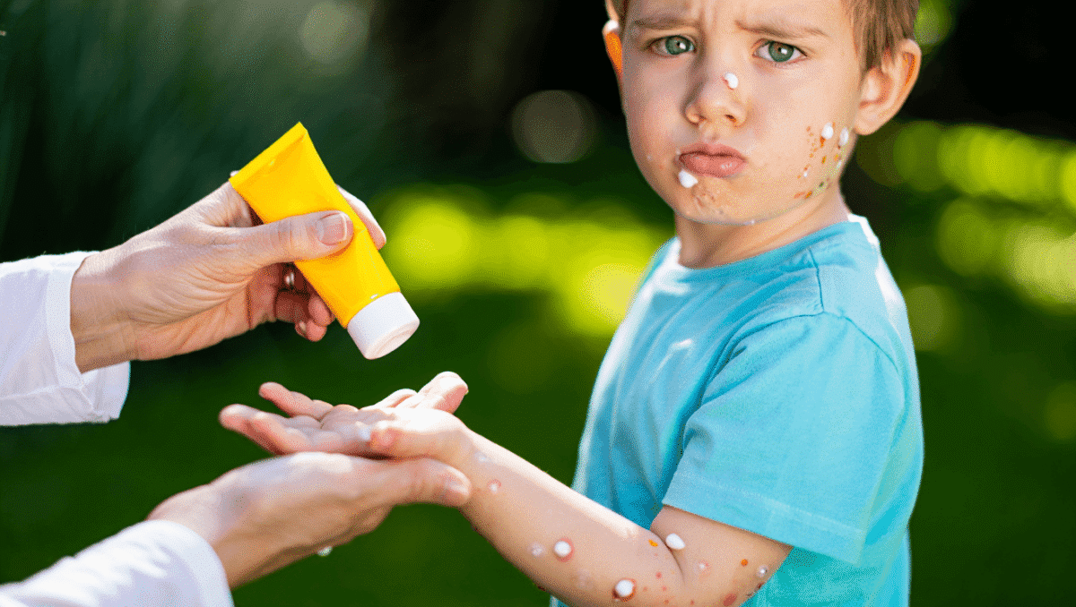 Enfants & adolescents – 24 mars 2023Varicelle et soleil : quels sont les risques ?La varicelle et le soleil ne font pas bon ménage. Nos médecins vous livrent leurs recommandations pour protéger votre enfant et éviter les complications.En savoir plus