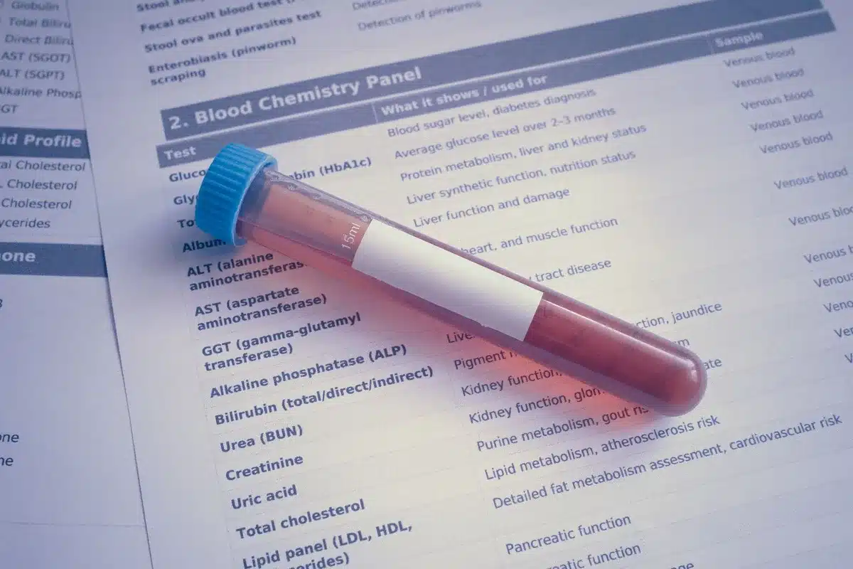 Pr&eacute;l&egrave;vement sanguin et tube de test pour l'analyse de cr&eacute;atinine et du DFG