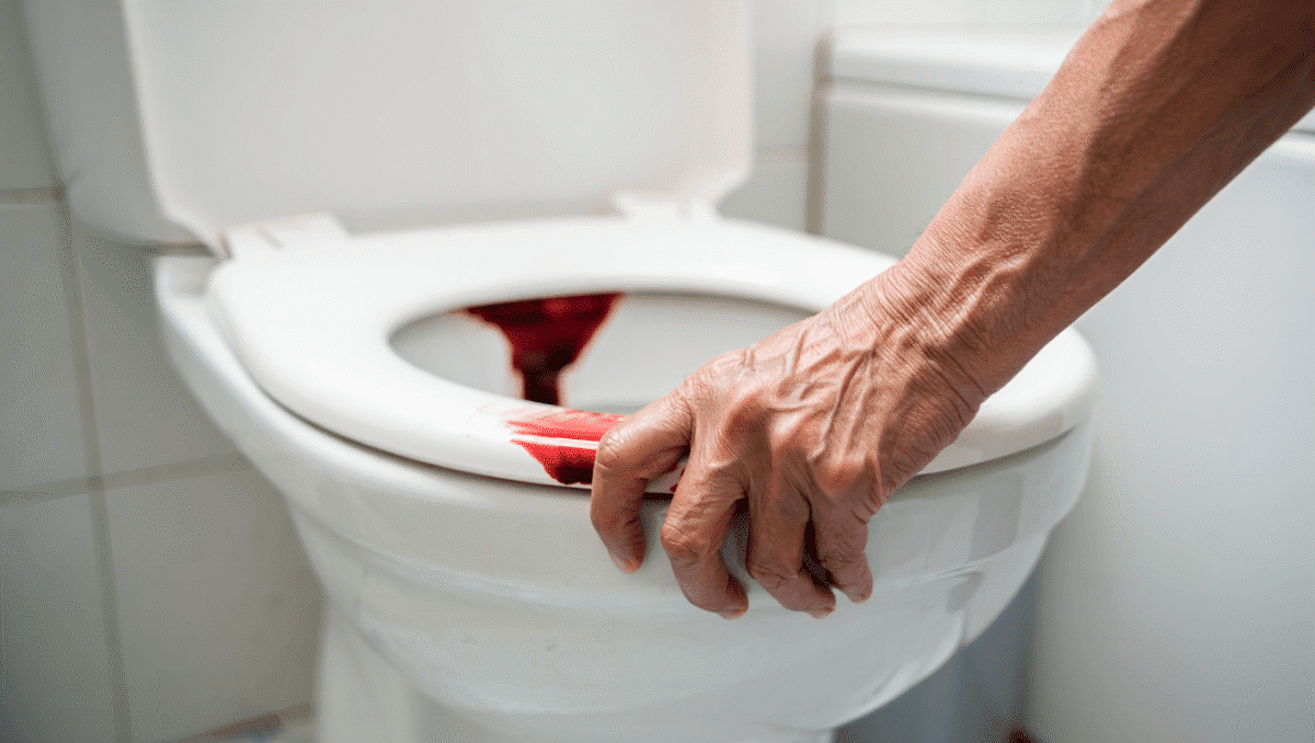 Digestion – 6 févr. 2023Sang dans les selles : quelles sont les causes ? Vous constatez la présence de sang dans vos selles ? Nos médecins généralistes et gastro-entérologues vous expliquent les causes de cette affection.En savoir plus