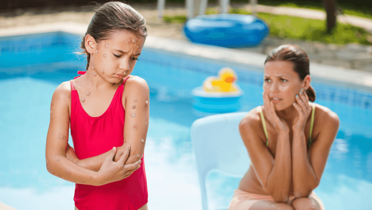 Dermatologie – 3 mars 2023Peut-on aller à la piscine quand on a la varicelle ?Peut-on aller à la piscine quand on a la varicelle ? Nos médecins vous disent tout si votre enfant est touché par ce virus très contagieux.En savoir plus