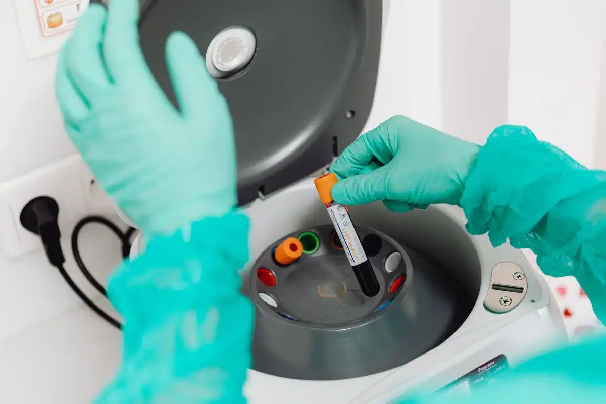 Tubes d'analyse sanguine et r&eacute;sultats de tests biologiques en laboratoire m&eacute;dical.