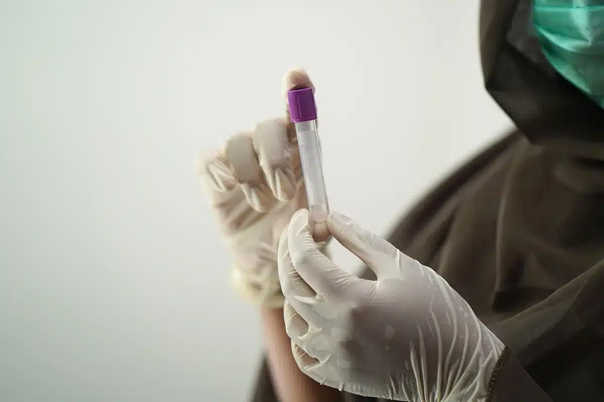 Pr&eacute;l&egrave;vement de selles pour test de d&eacute;pistage du sang occulte en laboratoire